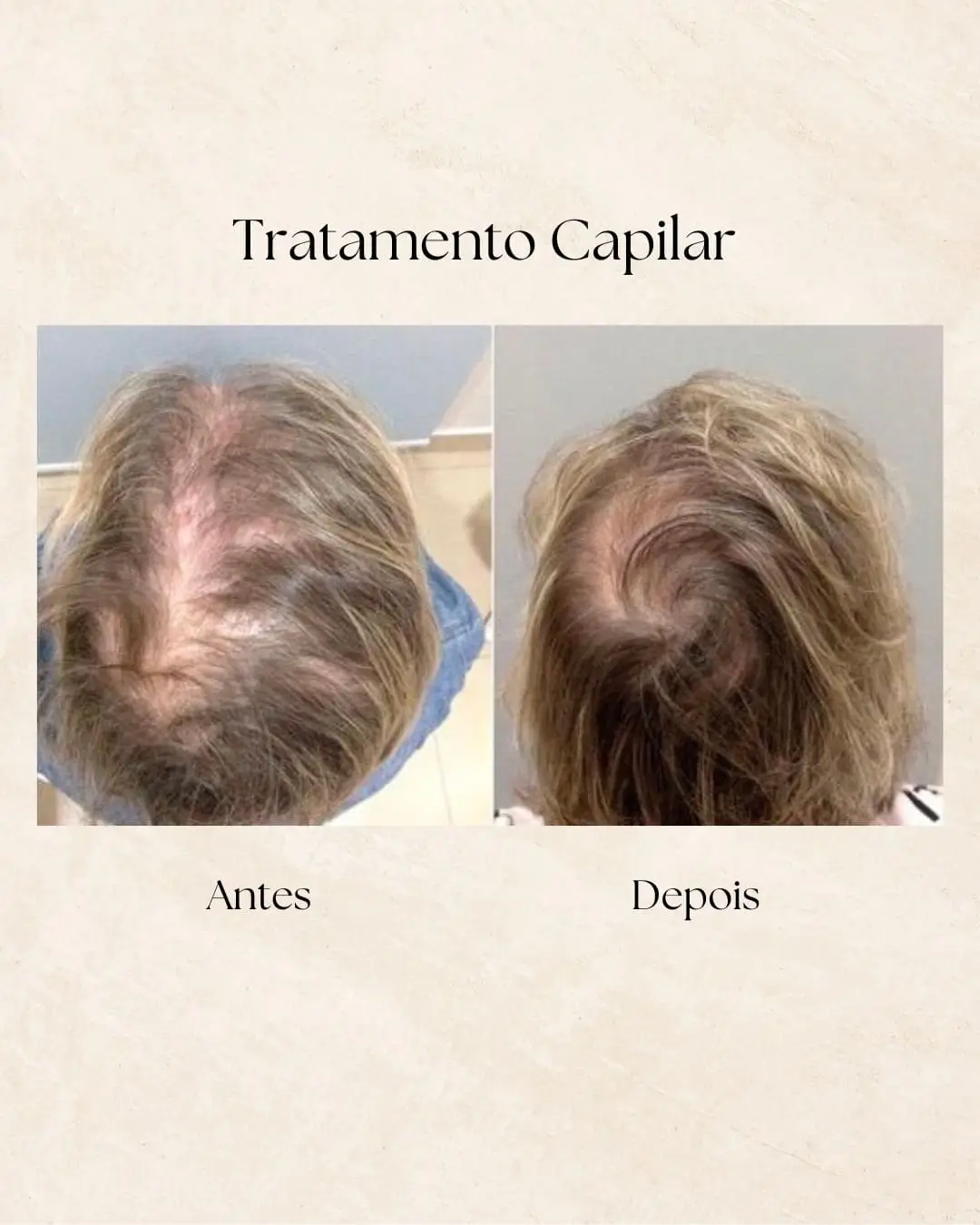 Tratamento capilar — resultado final