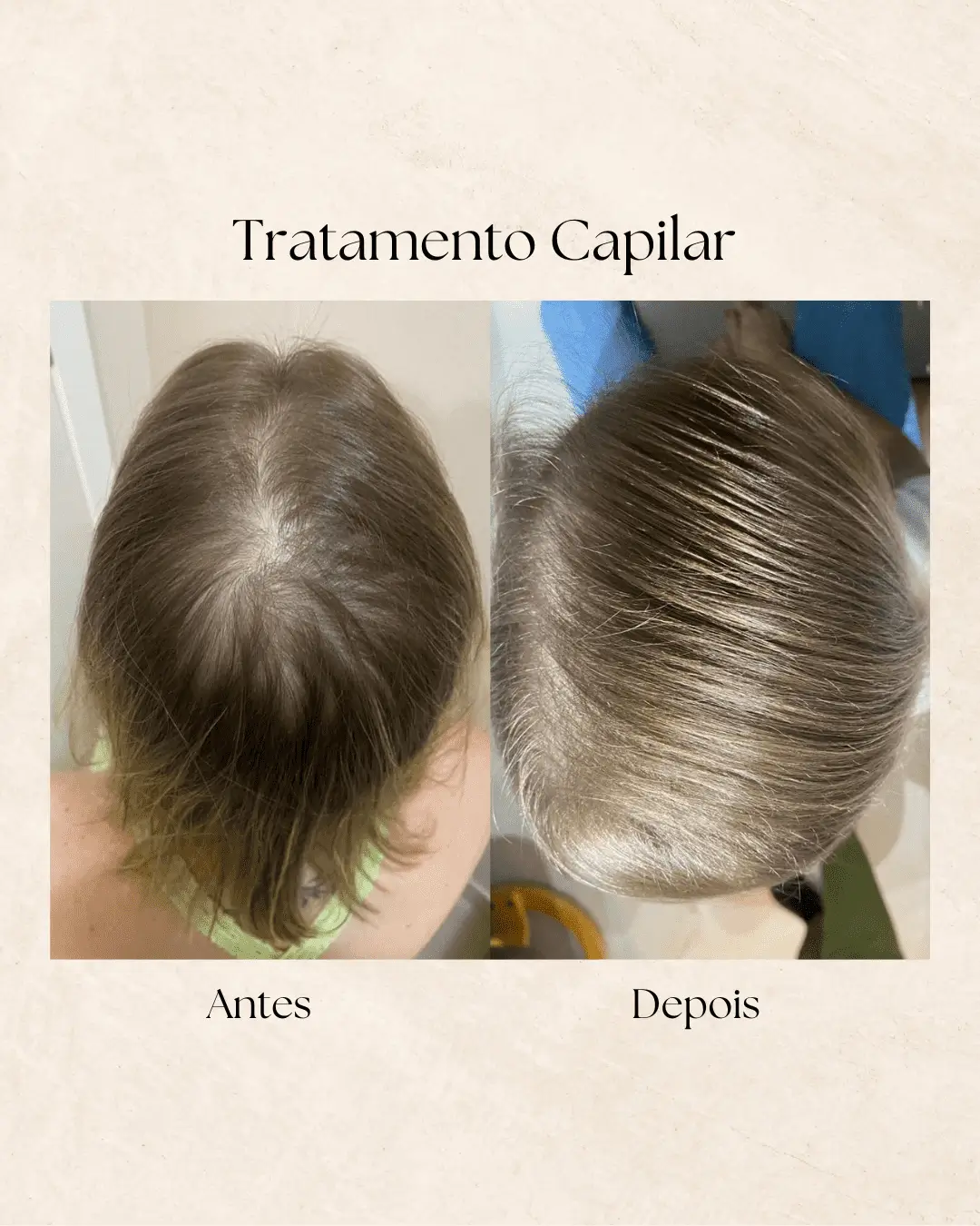 Tratamento capilar — resultado