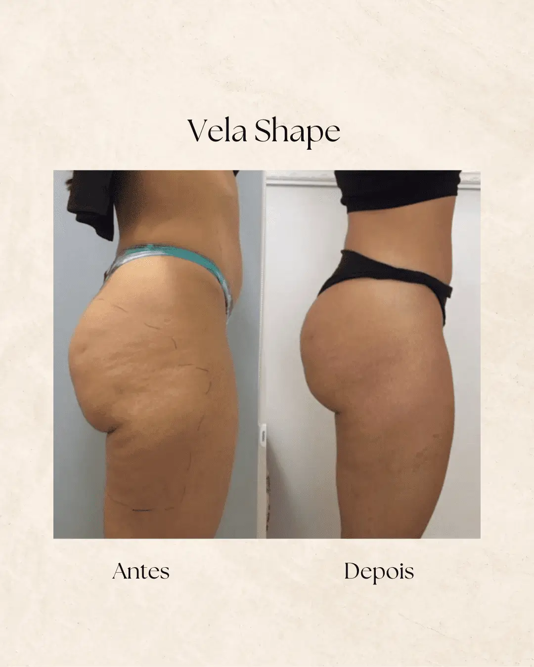 Vela Shape — resultado