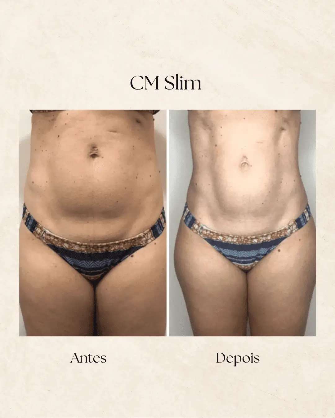 CM Slim — ganho de massa muscular