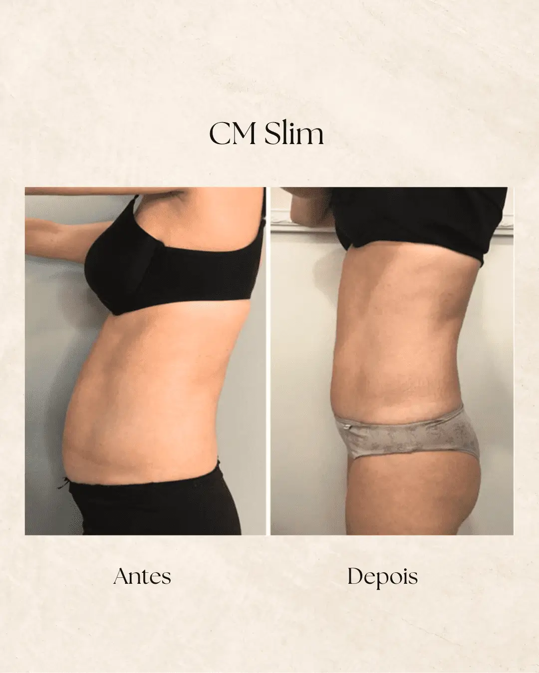 CM Slim — redução de gordura corporal