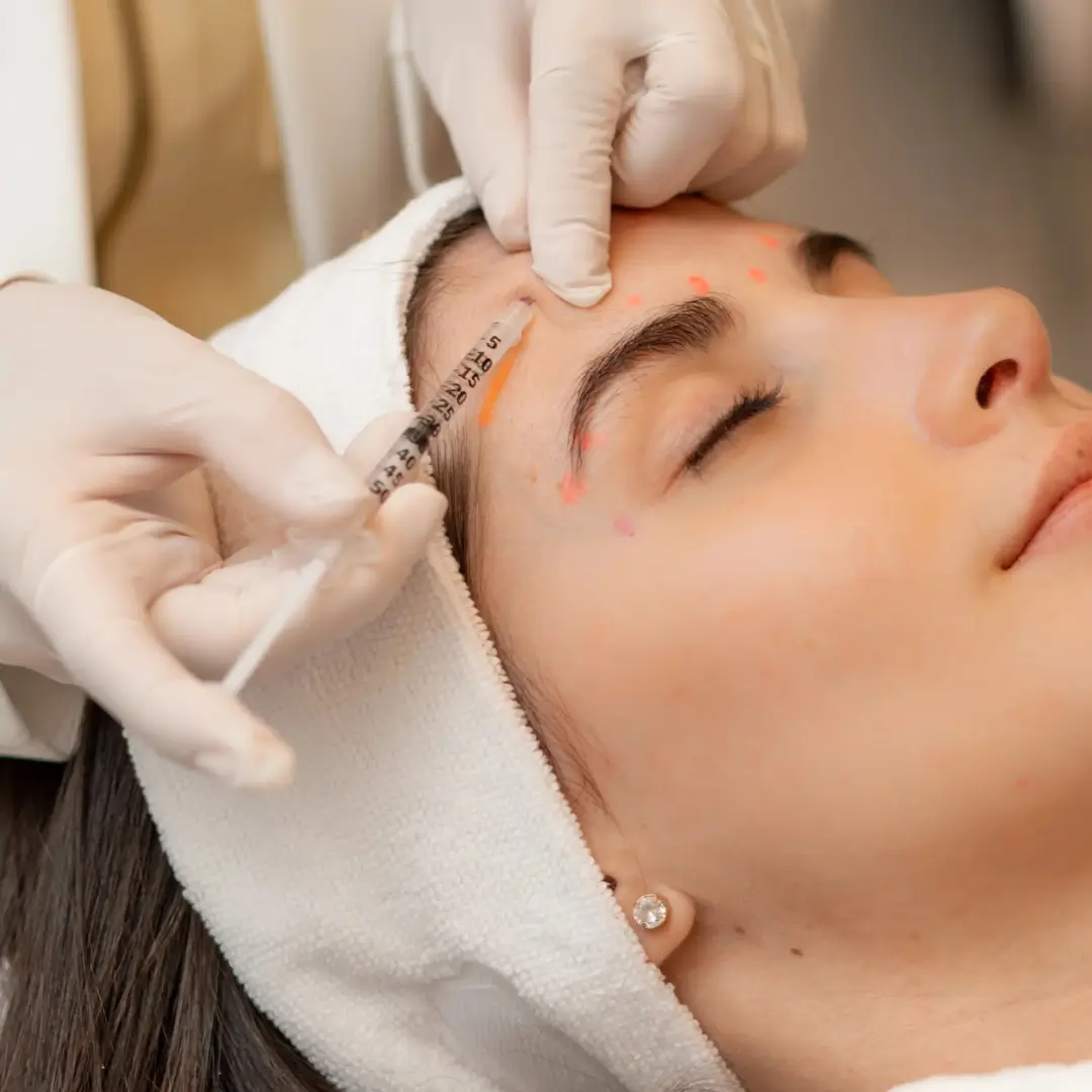 Aplicação de toxina botulínica no Botox Club da Dermique