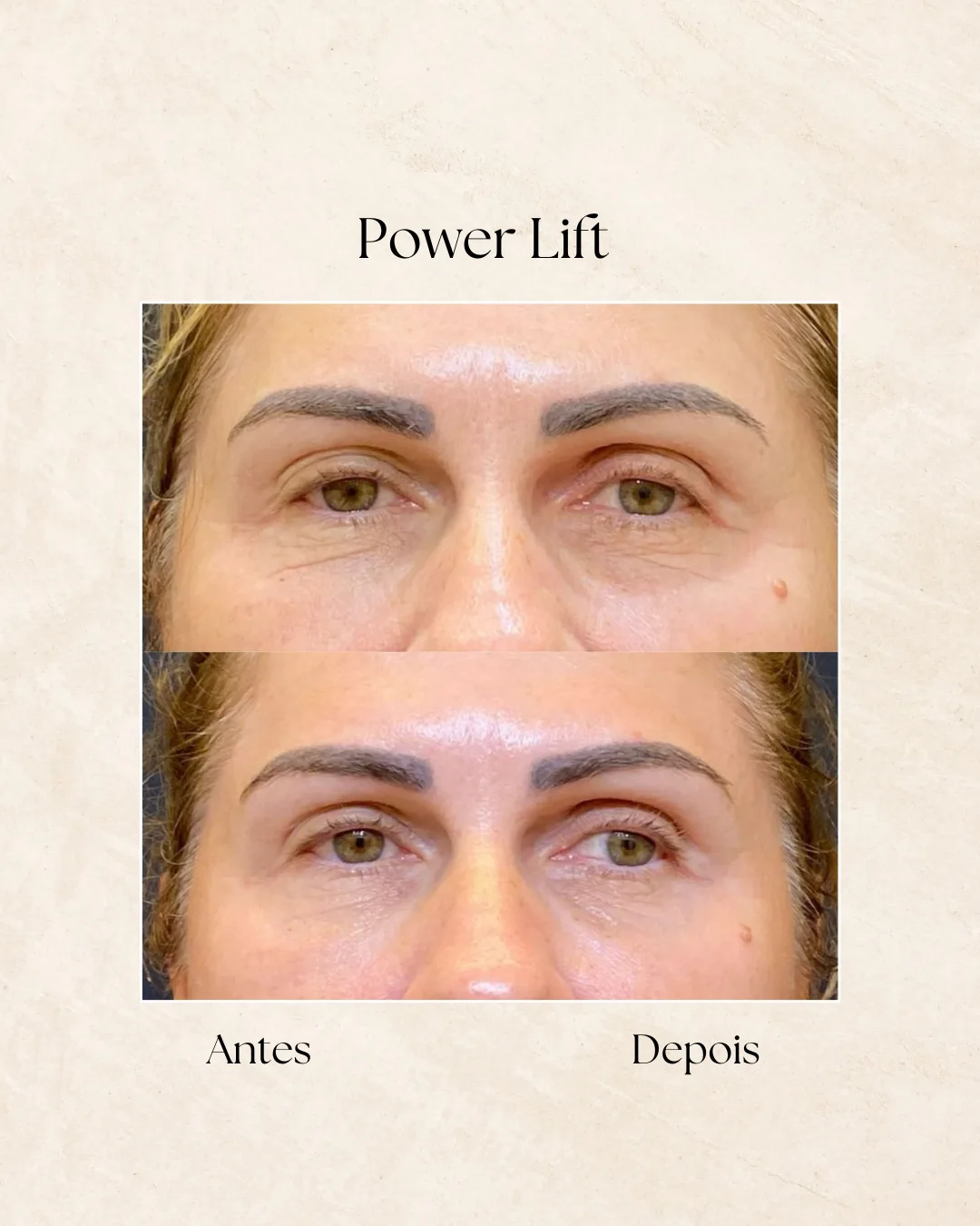 Power Lift antes e depois