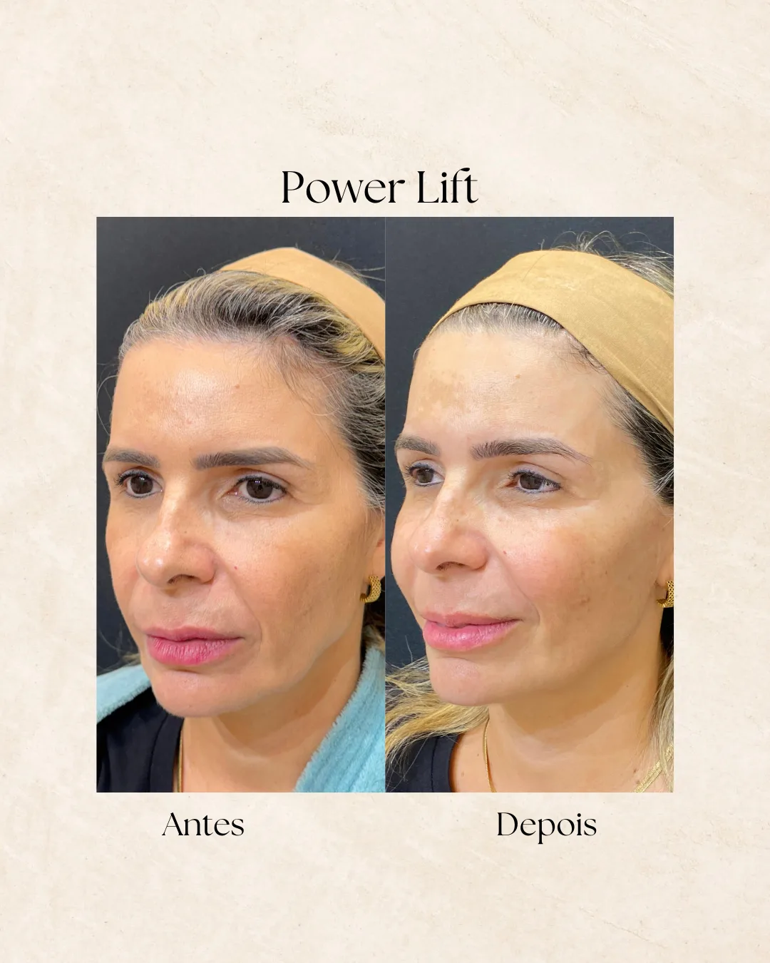 Power Lift antes e depois