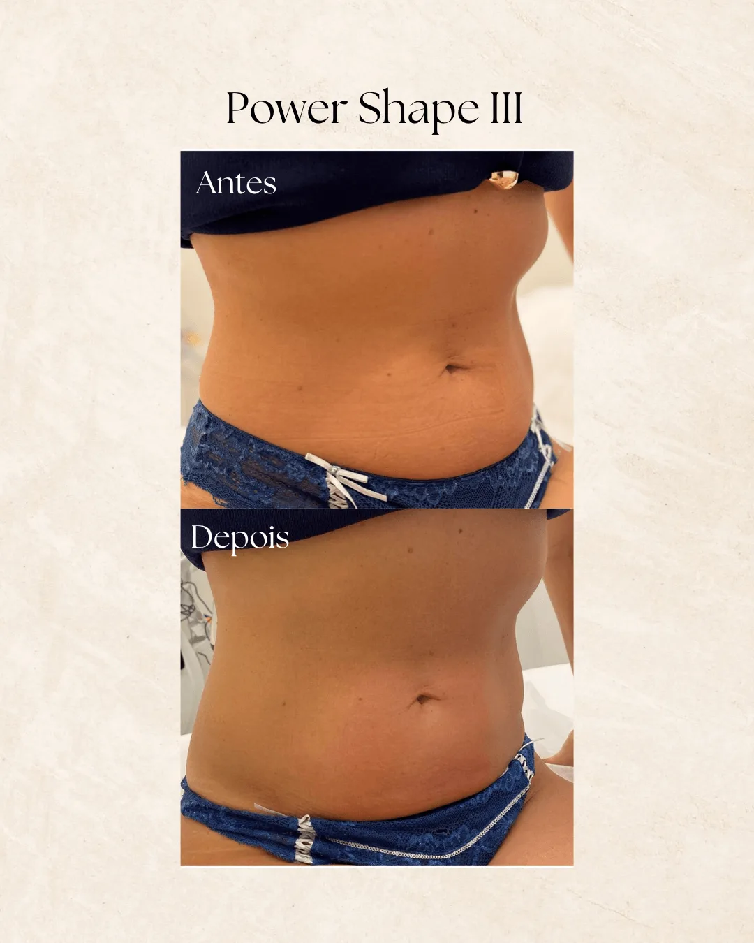 Power Shape III — antes e depois