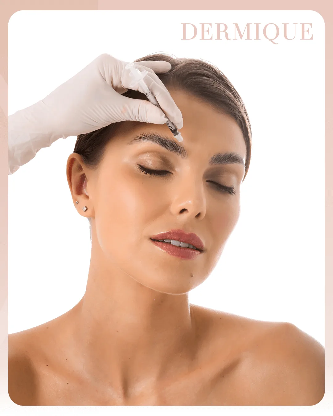 Resultado natural do Botox